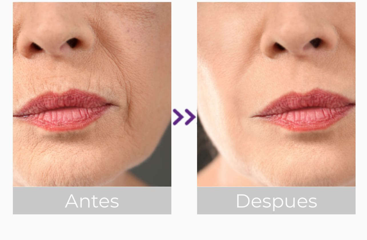 Fibroblastos: El Secreto para una Piel Joven y Saludable